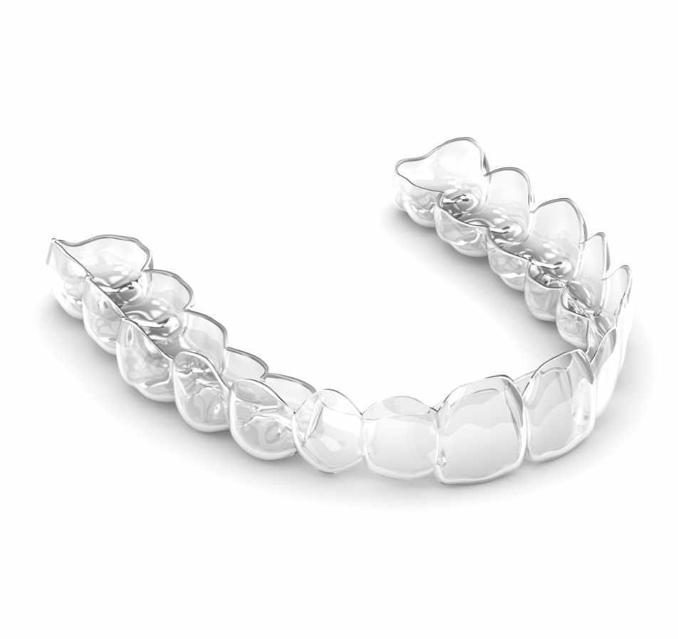 Aligner Behandlung